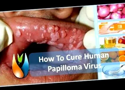 priznaky muza muza