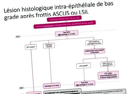 frottis ascus