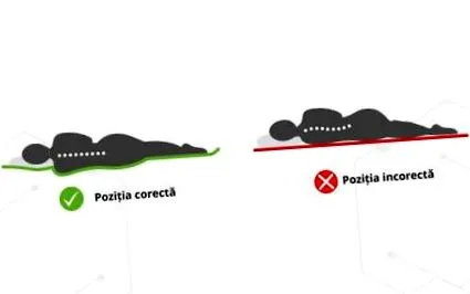 центрокинетичка