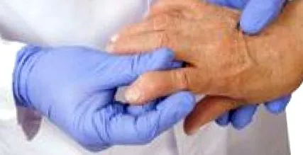 osteoarthritis osteoarthritis