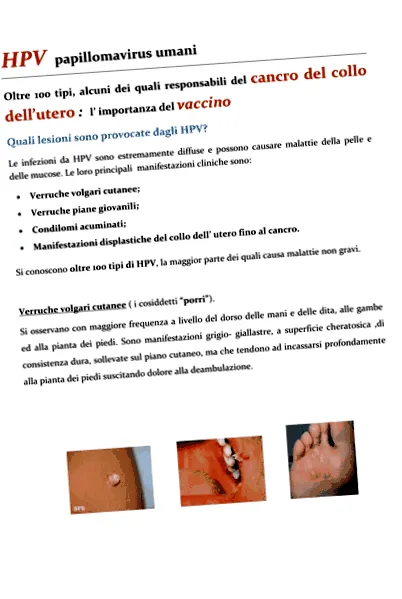 papilloma papilloma