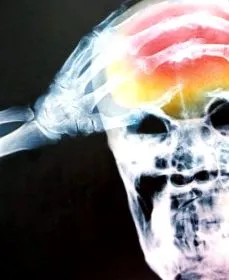 Brain Bank dragomir