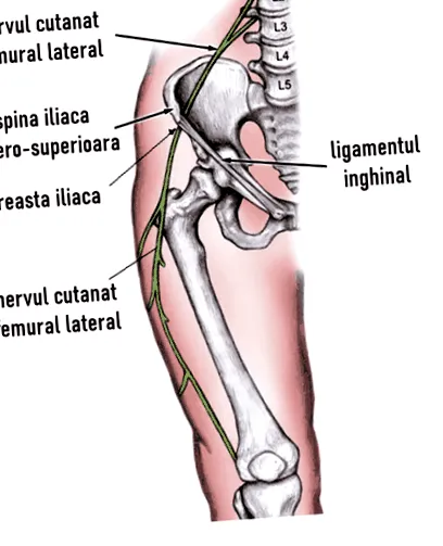 meralgia