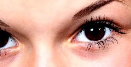 melanoma kezelés