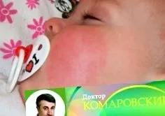 gyermek vörös