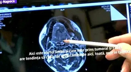 operáció-kommandó