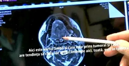 operáció-kommandó