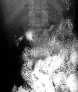 enterobiosis
