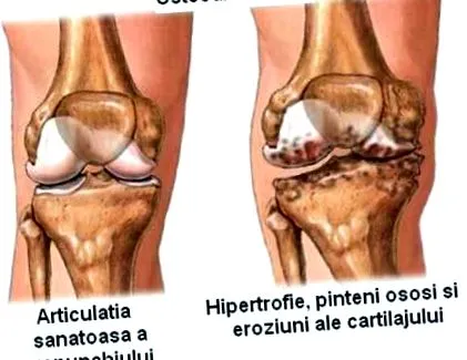 osteopathia