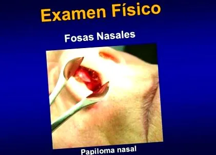 Papilloma krém