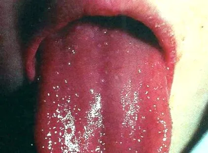 ugola