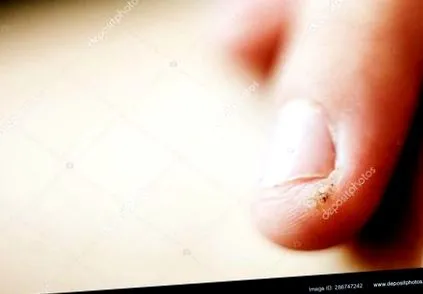 laphámsejtes tengelyben
