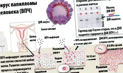 papilloma papilloma