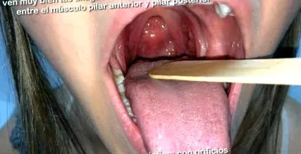 uvula