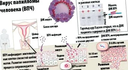 virusi