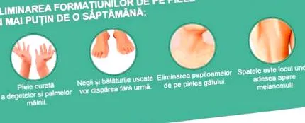 típusai