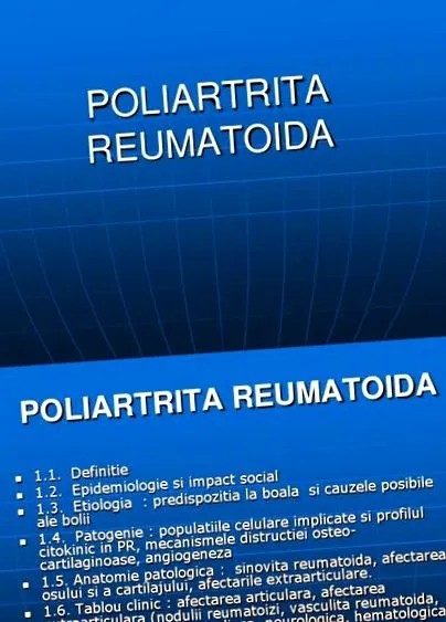 chorôb