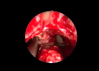 gastrointestinálneho
