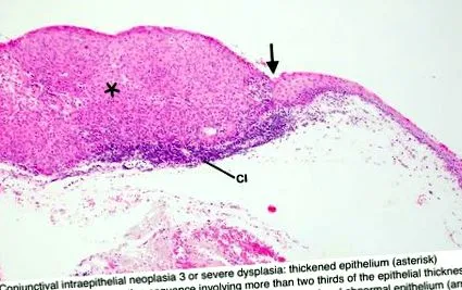 platyhelminthes