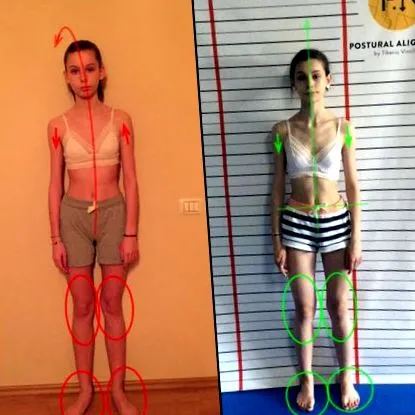 Postural Alignment