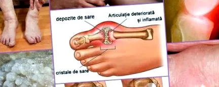 dermatitis
