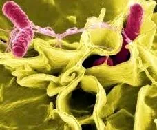 salmonellosis