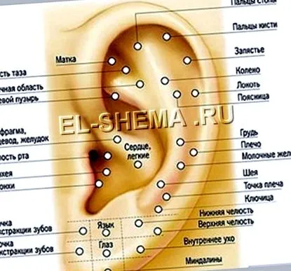 fascioliasis