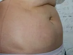 tabletták
