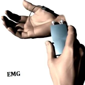 carpalis