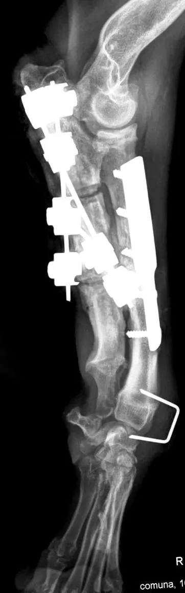 rövid ulna