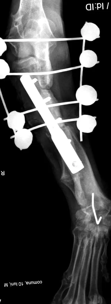 ulna
