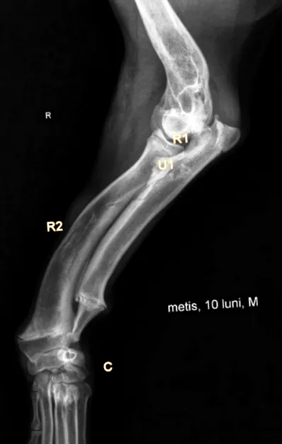 ulna