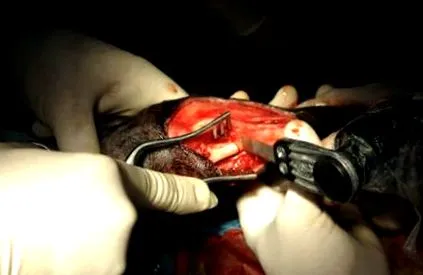 ulna