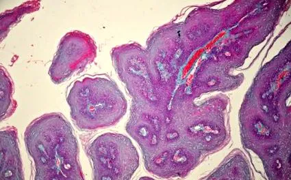 uvula