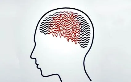 elektromos