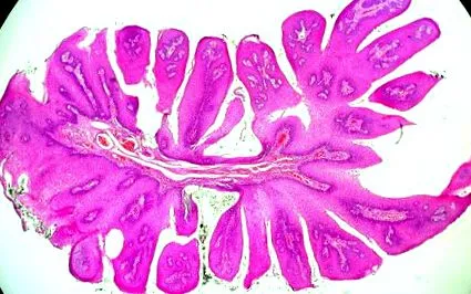 uvula