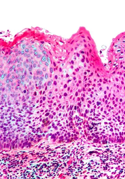 epidermalis