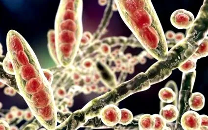 tinea corporis