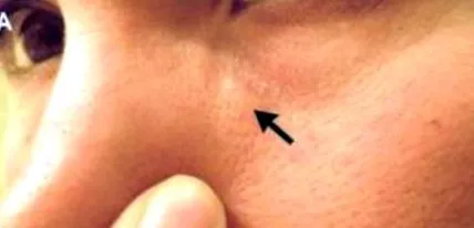 oropharynx oropharynx