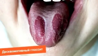gyógyszerek
