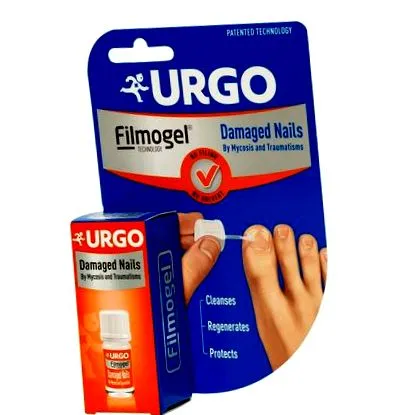 ízületi mycosis