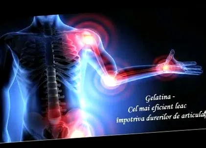 osteoarthritis