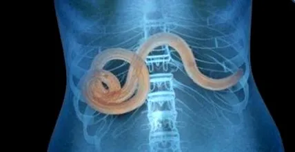 parazitáinak
