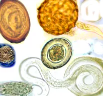 trichocephalosis