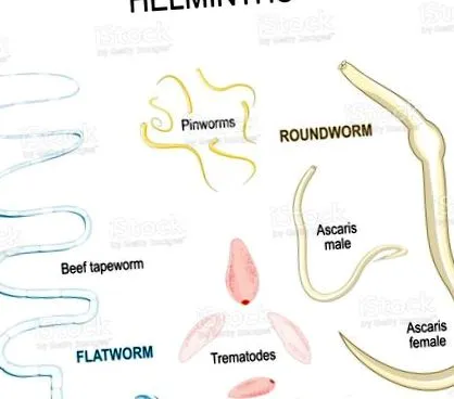 helminthiasis kezelése