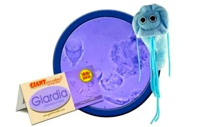 giardia