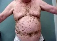 virus virus