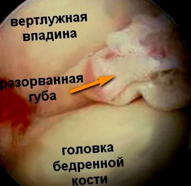 sérülései sérülése