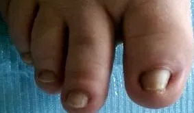 helyi trauma