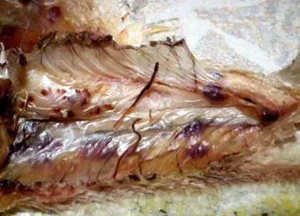 anti-schistosoma